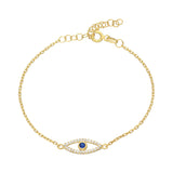 AUGE EFFECT ARMKETTE